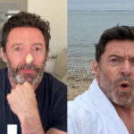 Cáncer de piel acecha a Hugh Jackman