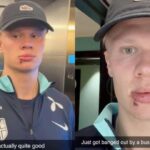 Haaland sufre accidente en autobus y comparte su herida con tres puntos de sutura