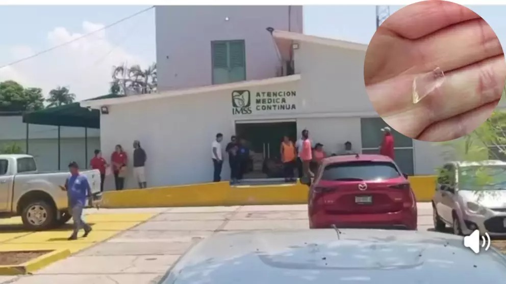Hospitalizan a estudiantes del CETMAR Manzanillo por consumir cochinita pibil… con vidrio