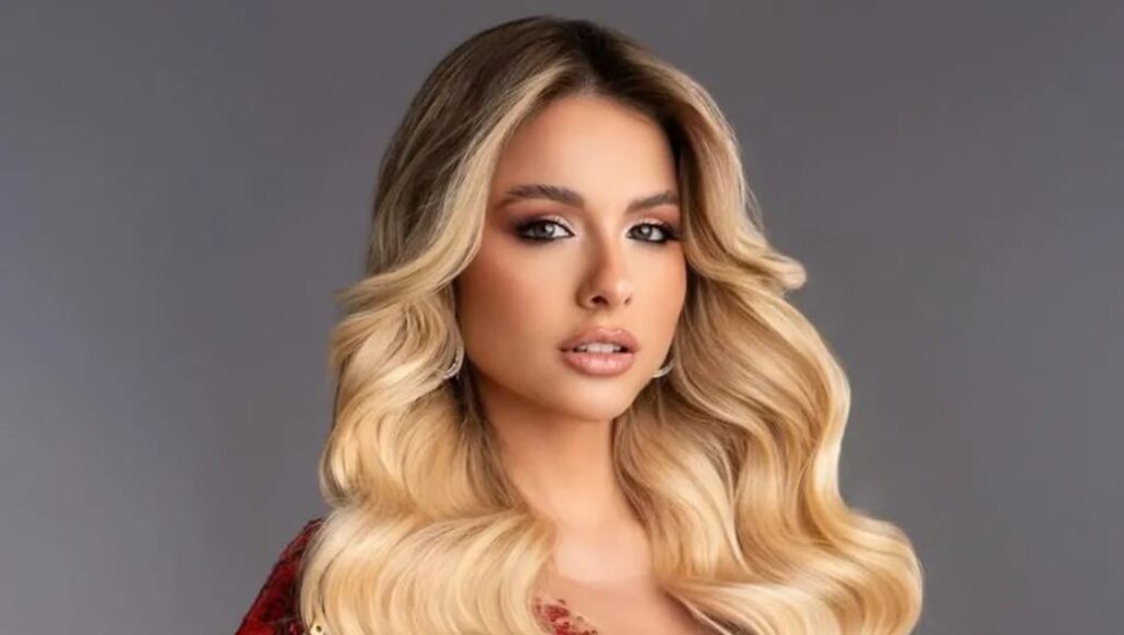 Miss Universo Argentina tiene alopecia; muestra la zona donde no le crece cabello: «Todos tenemos imperfecciones»