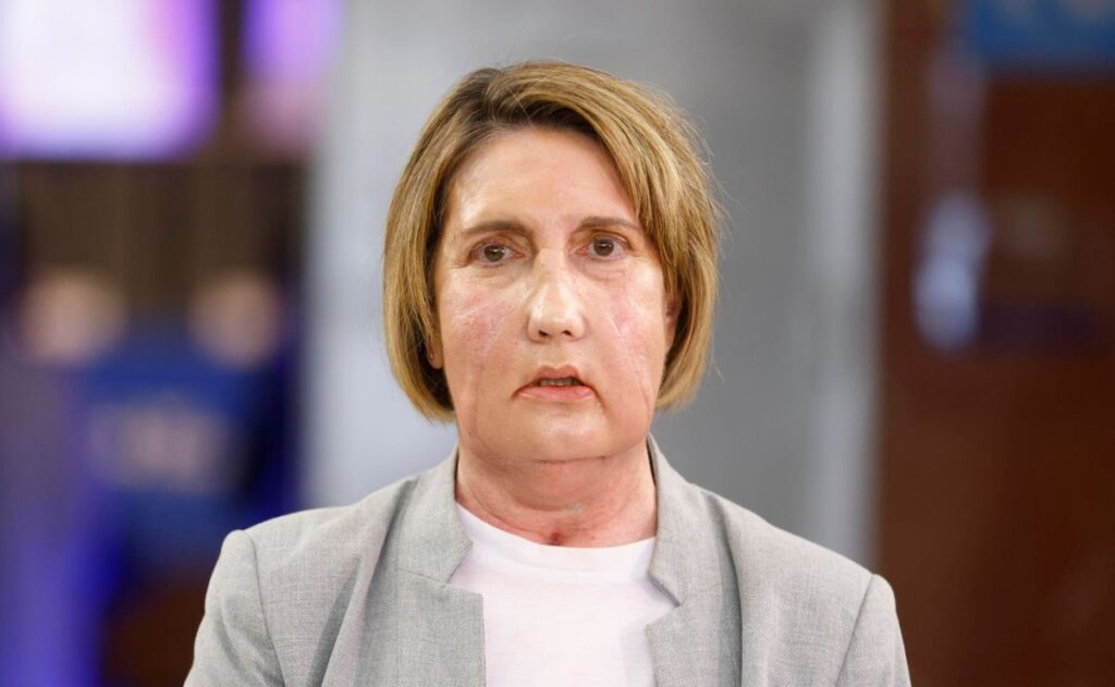 Realizan el primer trasplante facial del mundo con donante que recibió la eutanasia